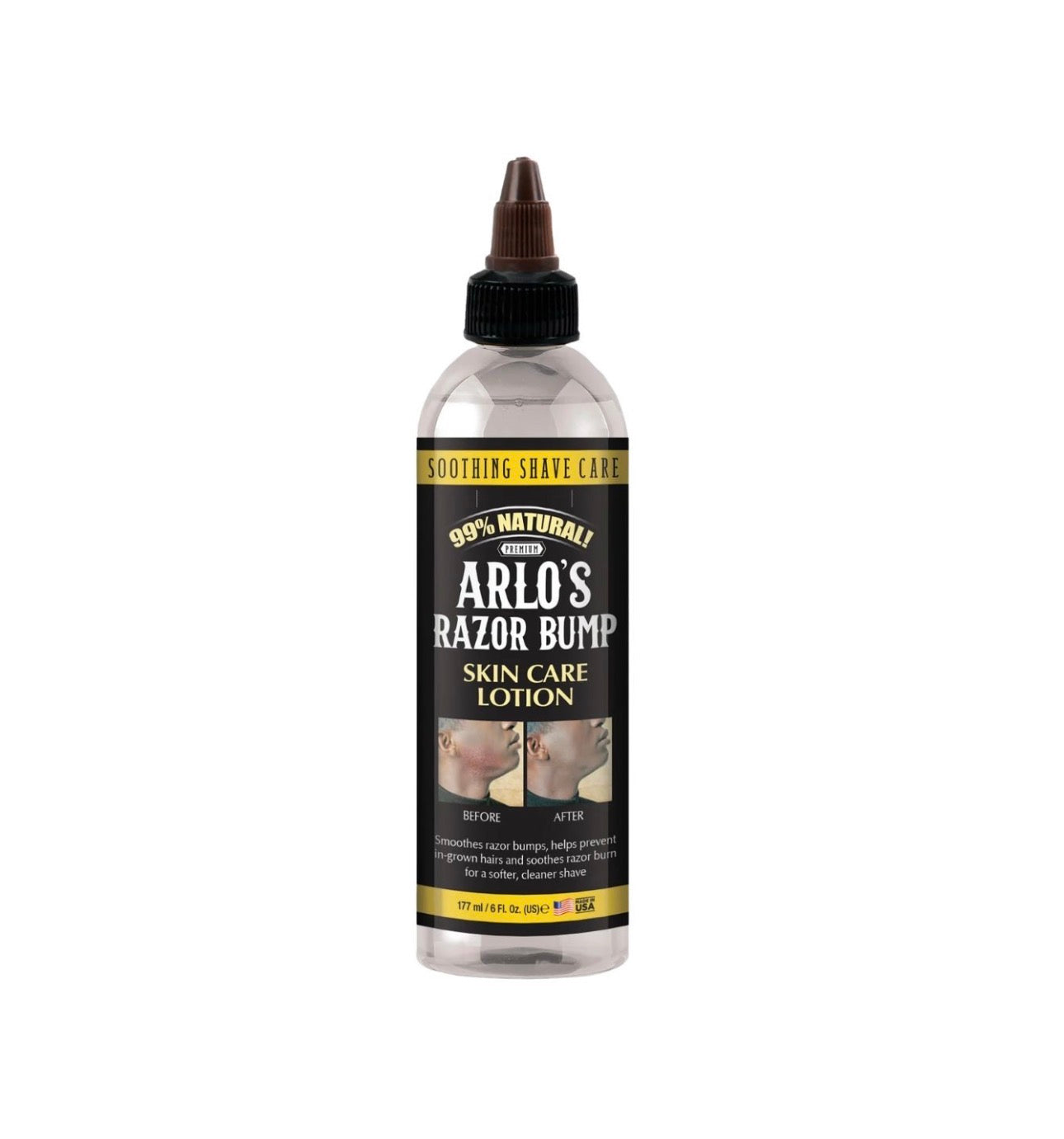 Arlo's Razor Bump Skin Lotion 6oz